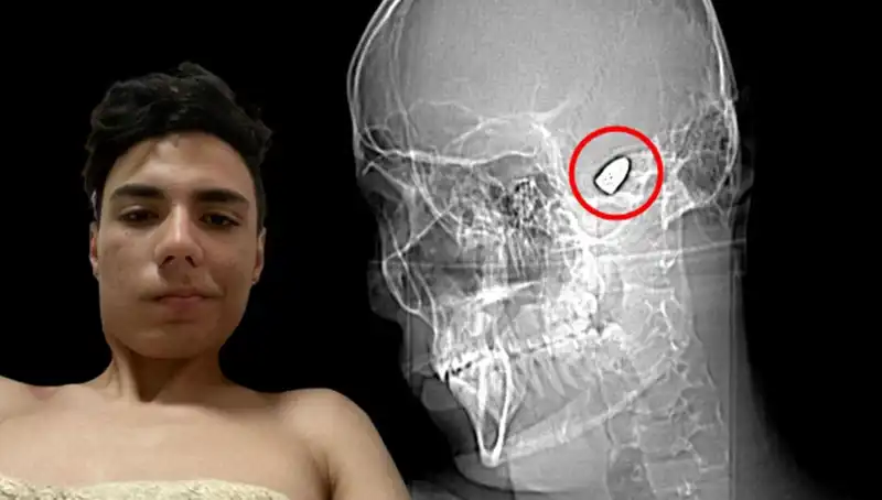 Kafasında Patlayan Duygular: Bomba Gibi Bir Ruh Hali